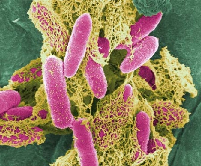 e.coli
