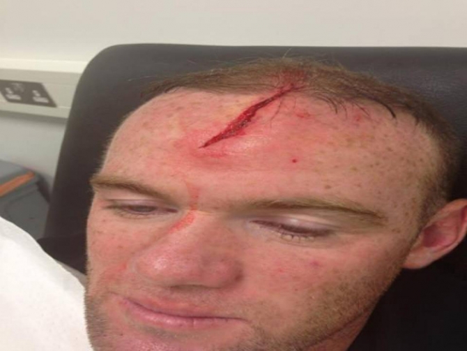 Rooney accidentare 2