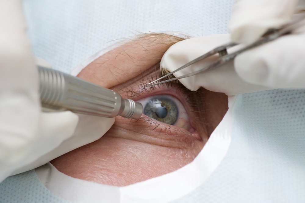 medicamentul pentru ochi deteriorează vederea