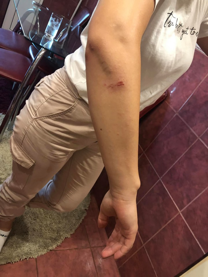Femeie agresată de hoațele adolescente din Cluj FOTO: Facebook Larisa