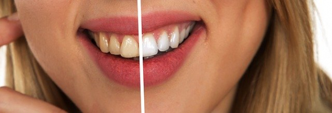 Rețetă naturală dinți albi