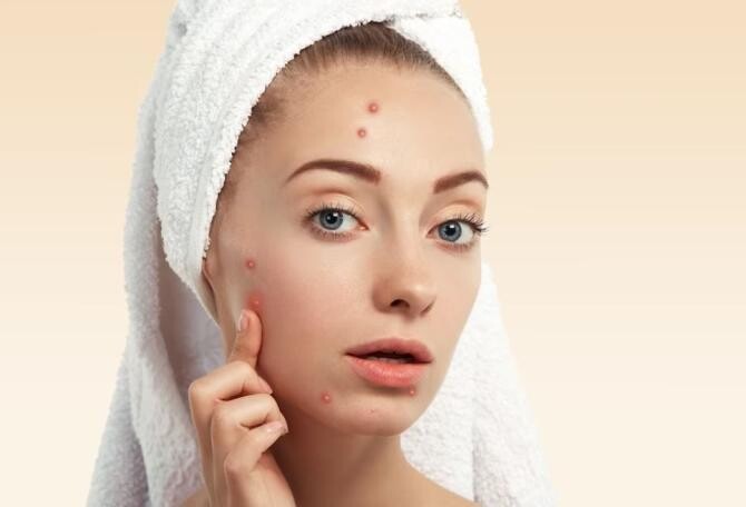 Ghimbirul tratează acneea, tonifică, întinerește și hrănește pielea. Află cum îl poți folosi. Sursa foto: freepik.com